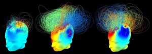 Brain's activity visualization