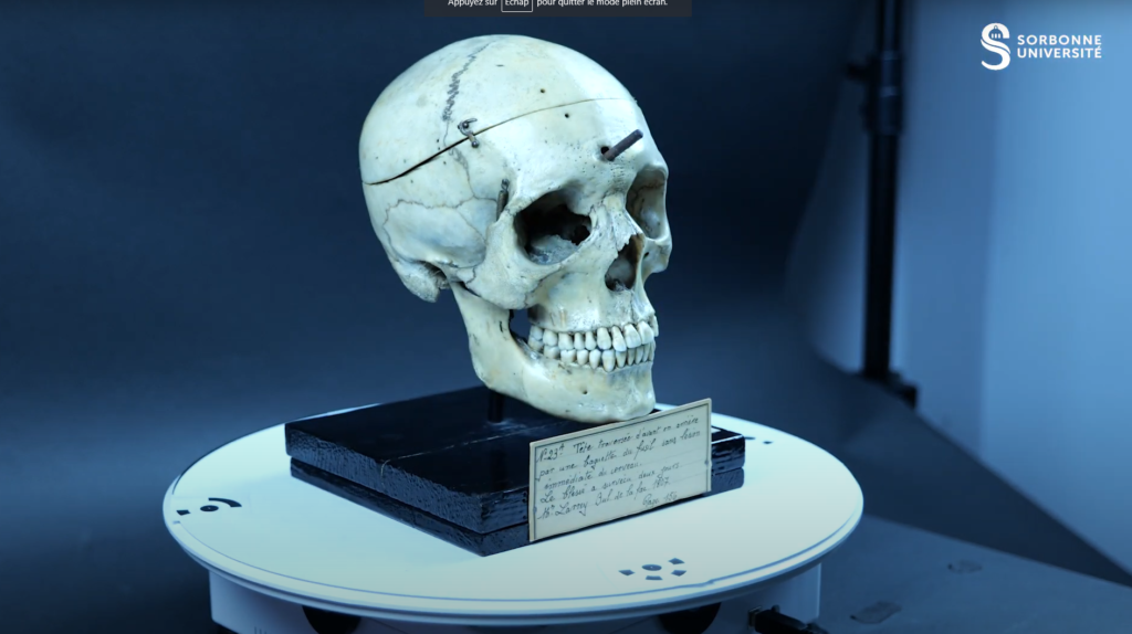Skull of Christophe Cros
